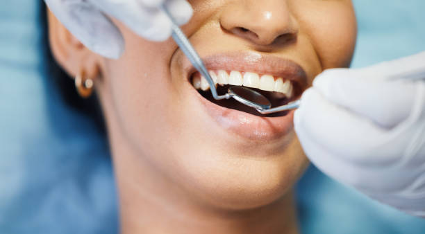 Best Pediatric Emergency Dentist in Naples, FL